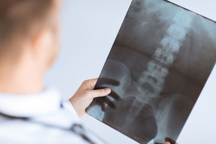 Opzioni diagnostiche per l'osteocondosi lombare