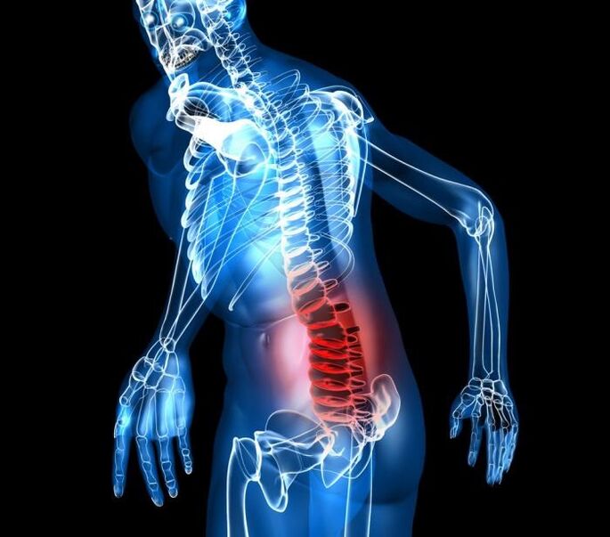 Stadi di laurea e sviluppo dell'osteocondosi lombare