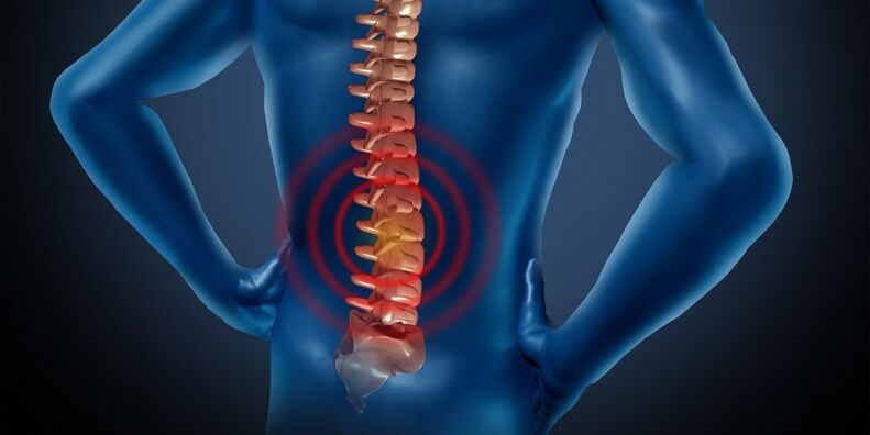 Osteocondrosi della regione lombare